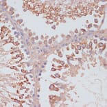 Immunohistochemistry - Anti-MRPL41 Antibody (A307403) - Antibodies.com