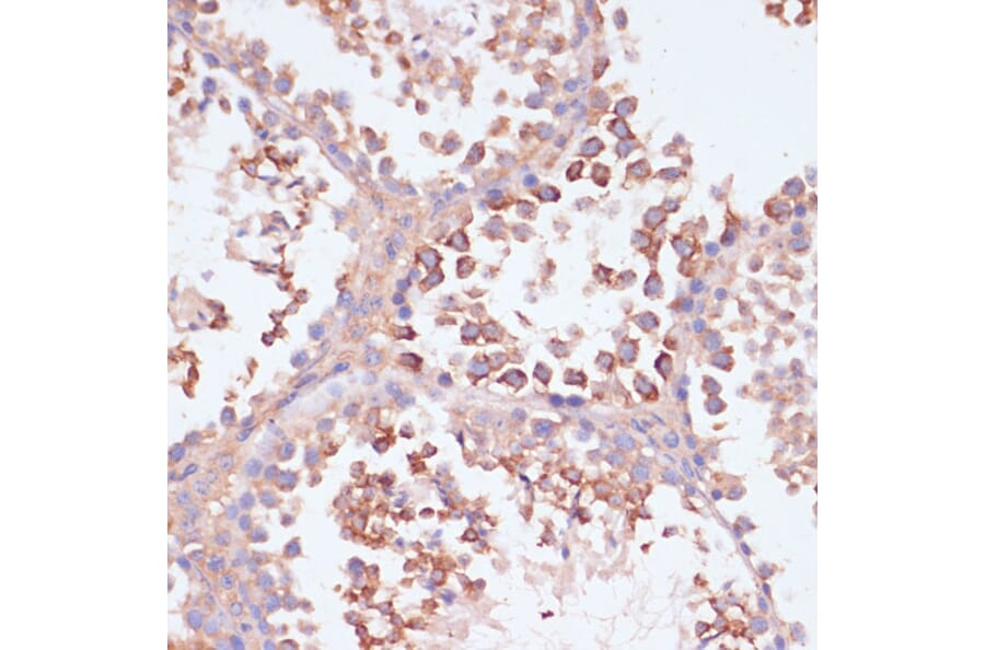 Immunohistochemistry - Anti-MRPL41 Antibody (A307403) - Antibodies.com