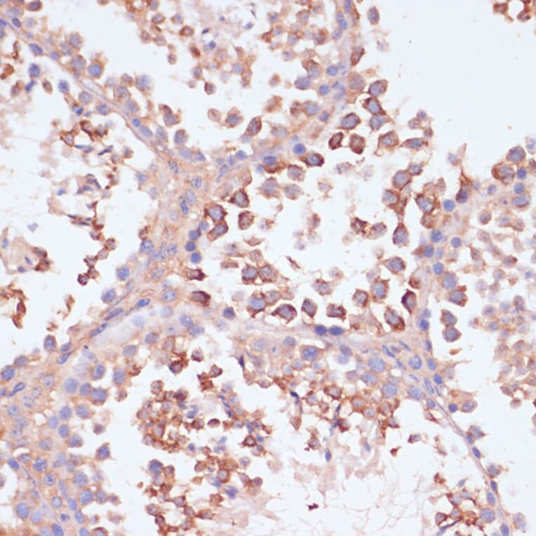 Immunohistochemistry - Anti-MRPL41 Antibody (A307403) - Antibodies.com