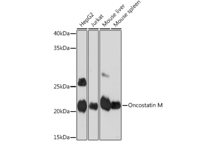 Western Blot - Anti-Oncostatin M/OSM Antibody [ARC1194] (A307404) - Antibodies.com