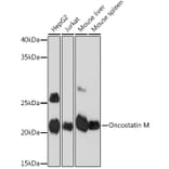 Western Blot - Anti-Oncostatin M/OSM Antibody [ARC1194] (A307404) - Antibodies.com
