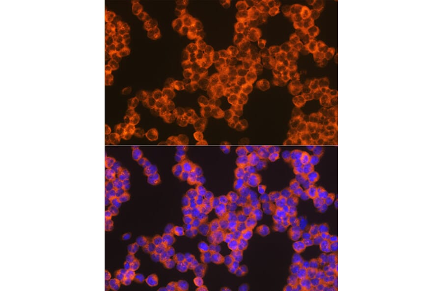 Immunofluorescence - Anti-Oncostatin M/OSM Antibody [ARC1194] (A307404) - Antibodies.com