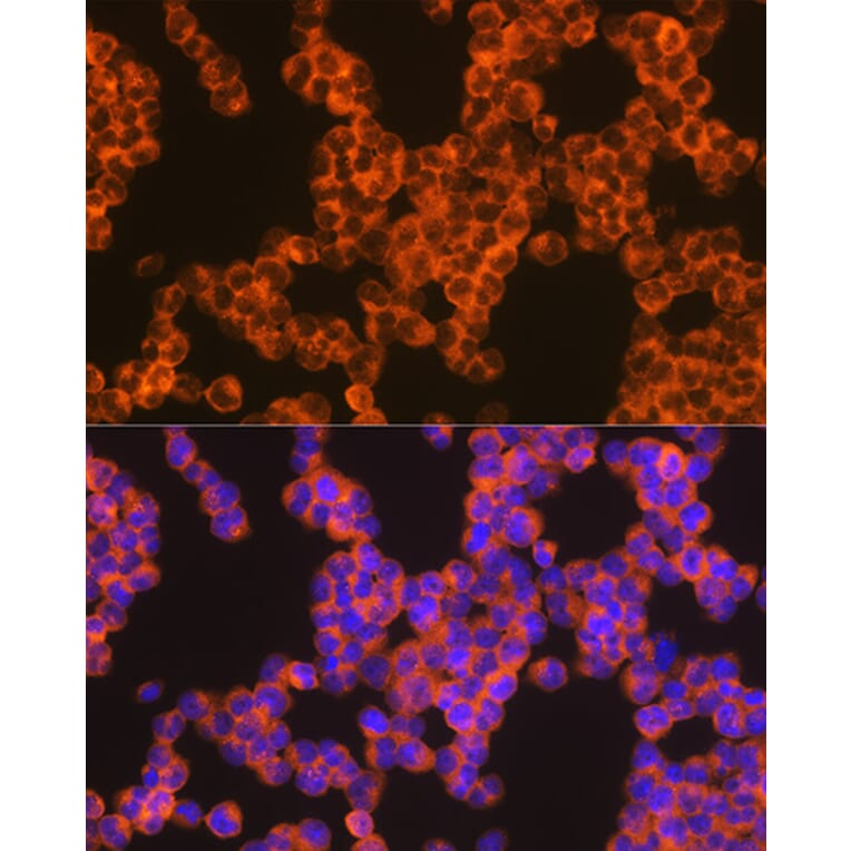Immunofluorescence - Anti-Oncostatin M/OSM Antibody [ARC1194] (A307404) - Antibodies.com