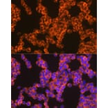Immunofluorescence - Anti-Oncostatin M/OSM Antibody [ARC1194] (A307404) - Antibodies.com