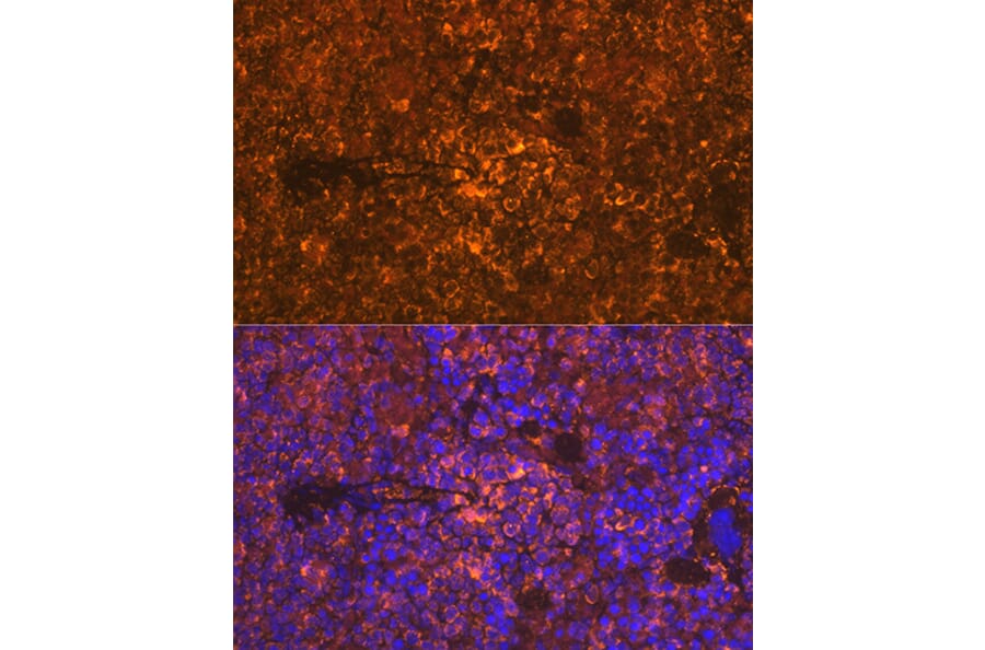 Immunofluorescence - Anti-Oncostatin M/OSM Antibody [ARC1194] (A307404) - Antibodies.com