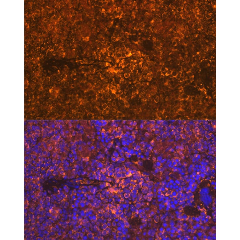 Immunofluorescence - Anti-Oncostatin M/OSM Antibody [ARC1194] (A307404) - Antibodies.com