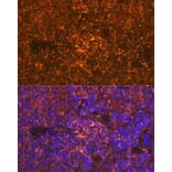 Immunofluorescence - Anti-Oncostatin M/OSM Antibody [ARC1194] (A307404) - Antibodies.com