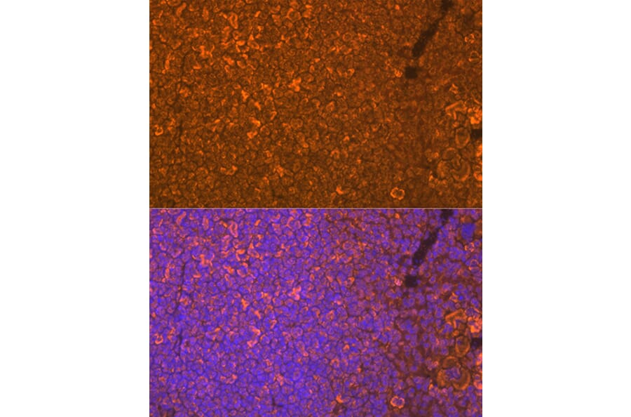 Immunofluorescence - Anti-Oncostatin M/OSM Antibody [ARC1194] (A307404) - Antibodies.com