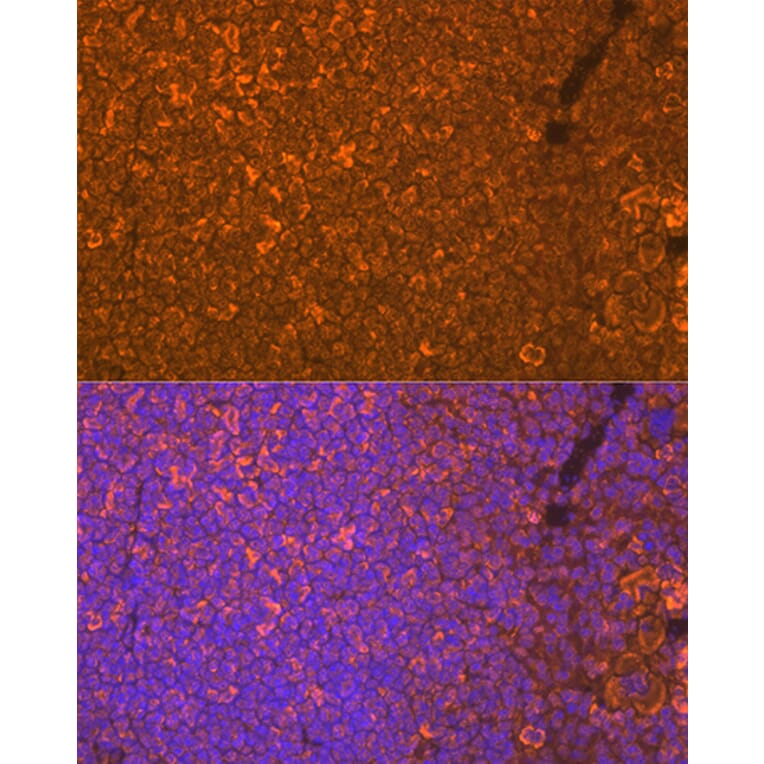 Immunofluorescence - Anti-Oncostatin M/OSM Antibody [ARC1194] (A307404) - Antibodies.com