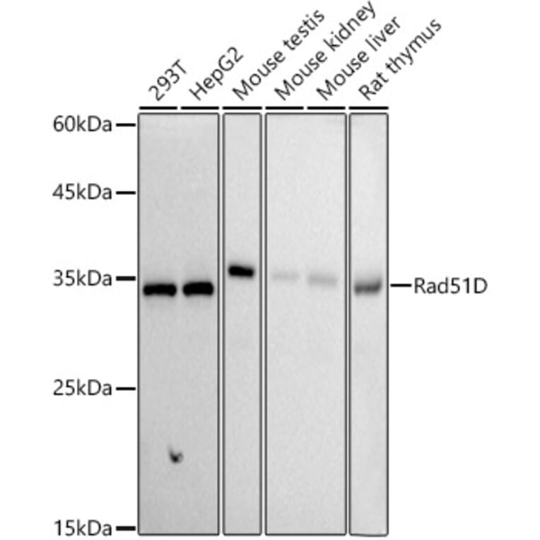 Western Blot - Anti-Rad51D Antibody [ARC2800] (A307405) - Antibodies.com
