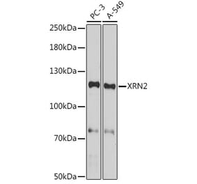 Western Blot - Anti-XRN2 Antibody (A307406) - Antibodies.com