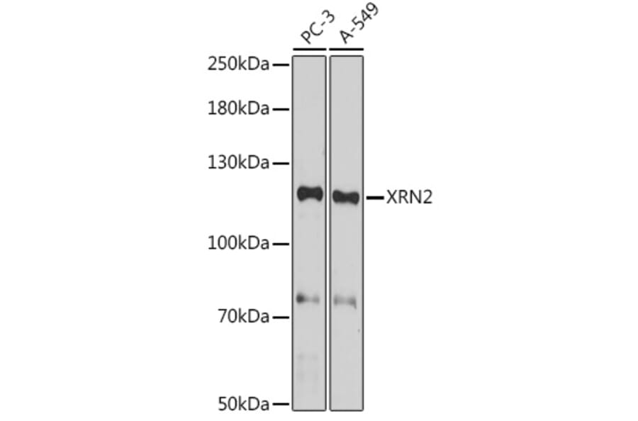 Western Blot - Anti-XRN2 Antibody (A307406) - Antibodies.com