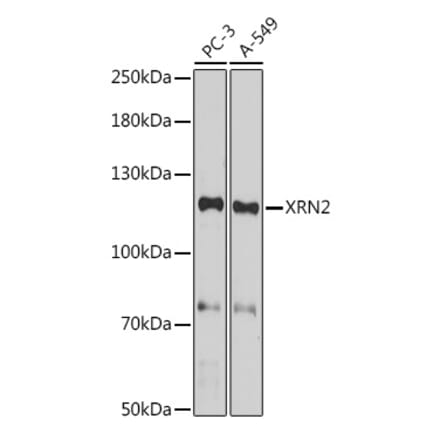 Western Blot - Anti-XRN2 Antibody (A307406) - Antibodies.com