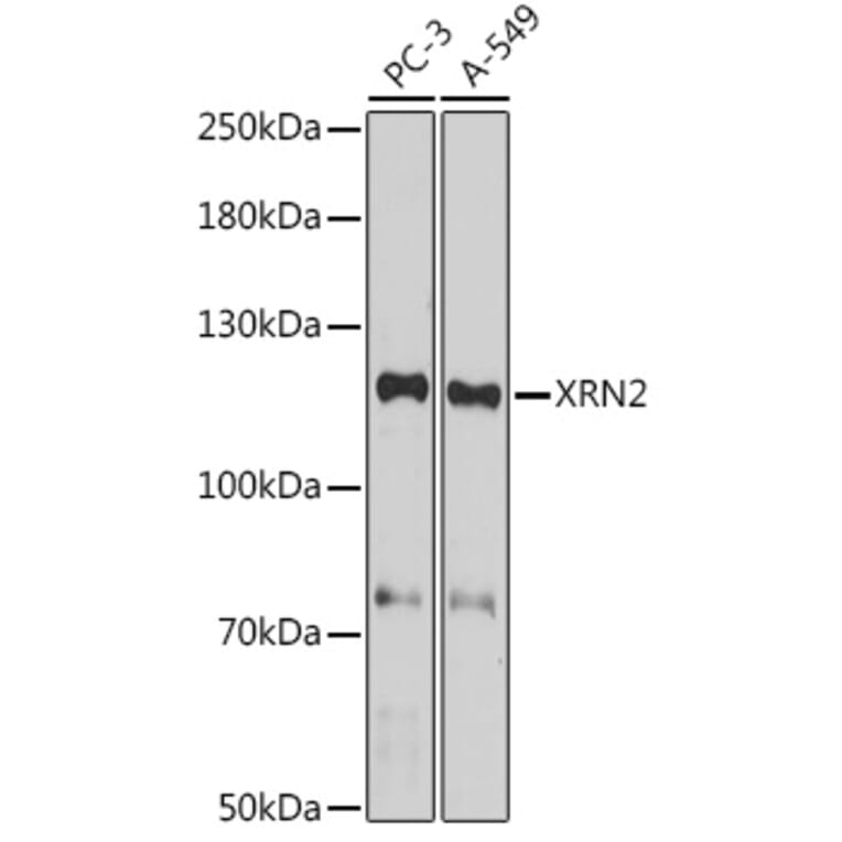 Western Blot - Anti-XRN2 Antibody (A307406) - Antibodies.com