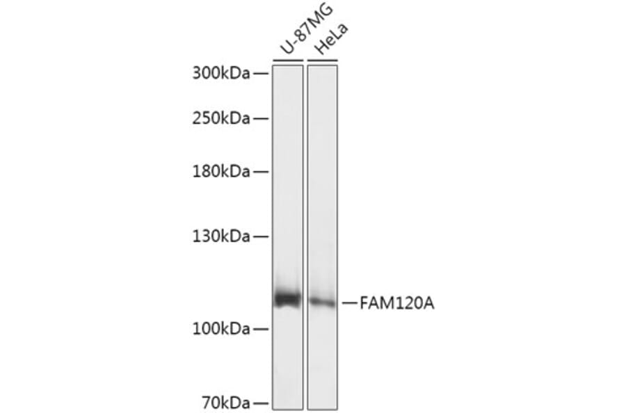 Western Blot - Anti-FAM120A/OSSA Antibody (A307407) - Antibodies.com