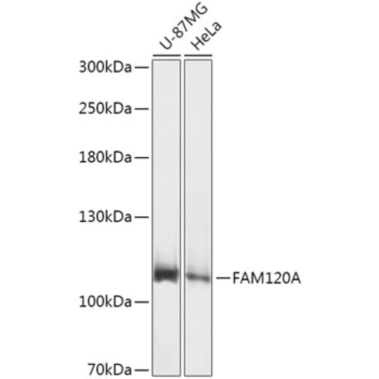 Western Blot - Anti-FAM120A/OSSA Antibody (A307407) - Antibodies.com