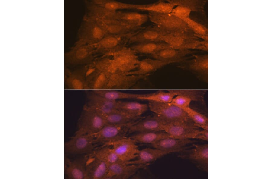 Immunofluorescence - Anti-ISG15 Antibody [ARC53794] (A307409) - Antibodies.com