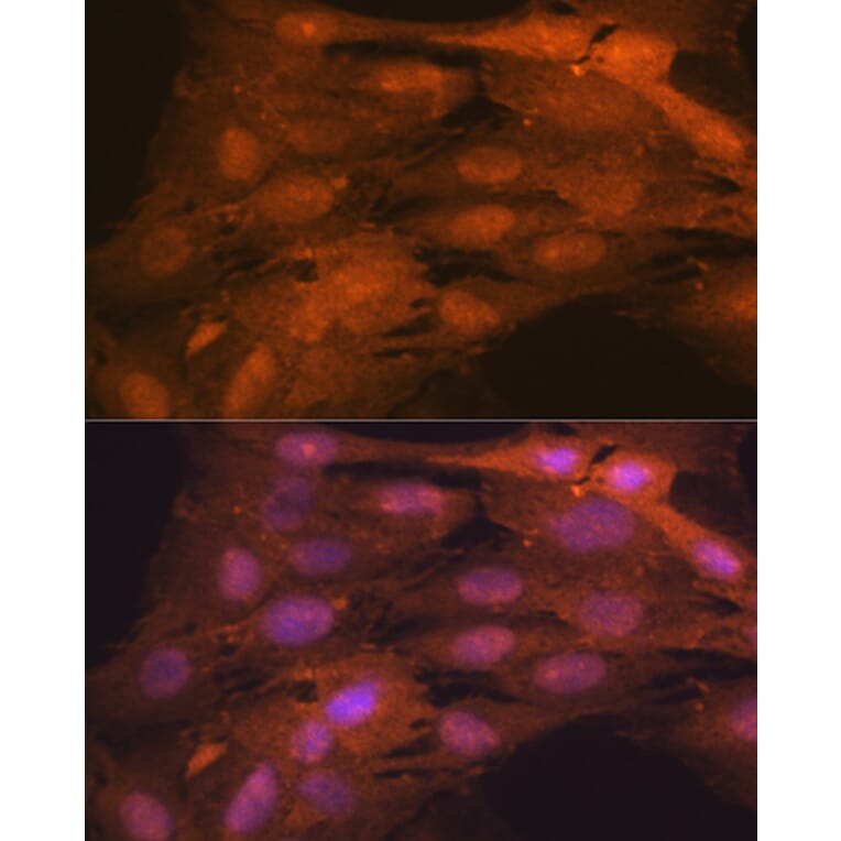 Immunofluorescence - Anti-ISG15 Antibody [ARC53794] (A307409) - Antibodies.com