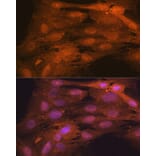 Immunofluorescence - Anti-ISG15 Antibody [ARC53794] (A307409) - Antibodies.com