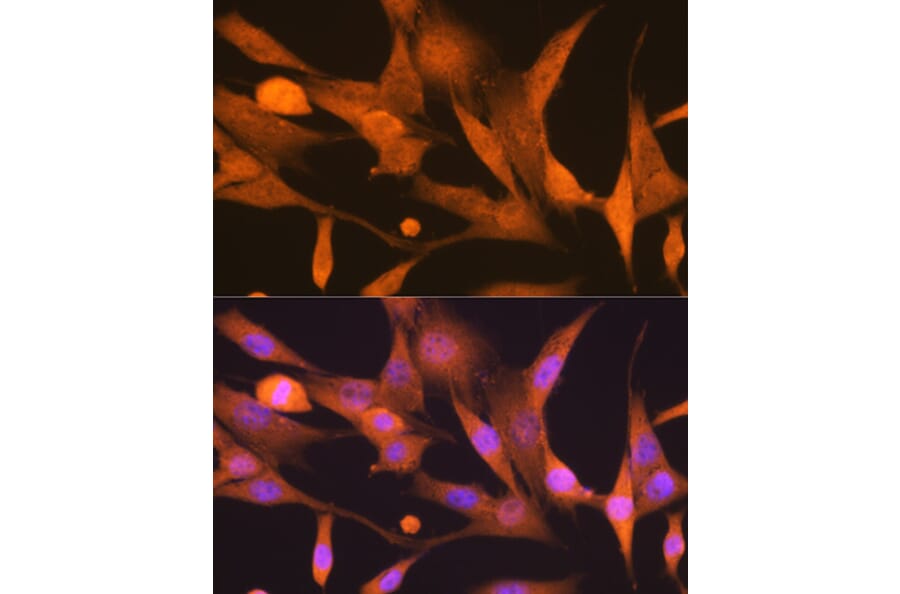 Immunofluorescence - Anti-ISG15 Antibody [ARC53794] (A307409) - Antibodies.com