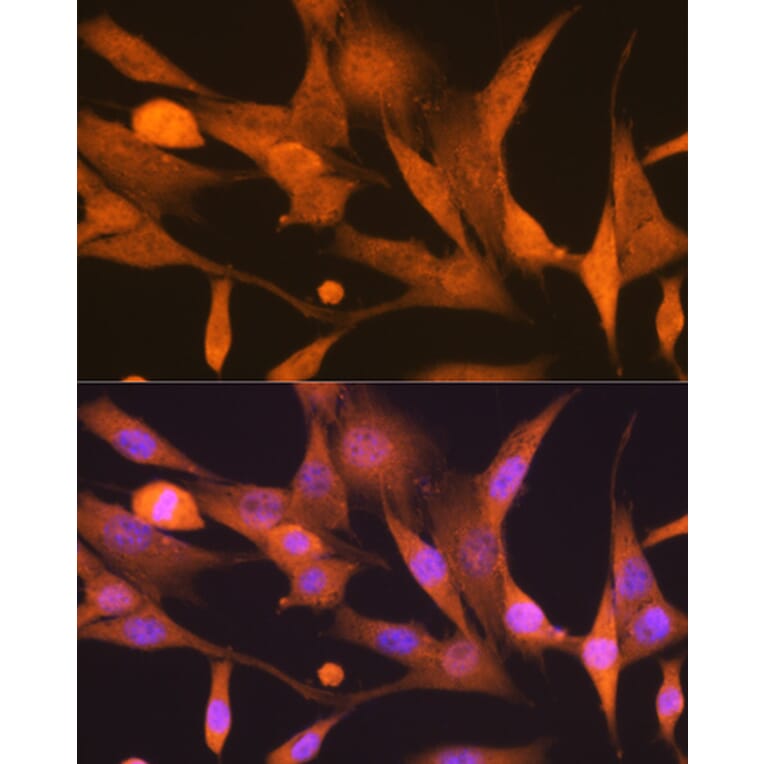 Immunofluorescence - Anti-ISG15 Antibody [ARC53794] (A307409) - Antibodies.com