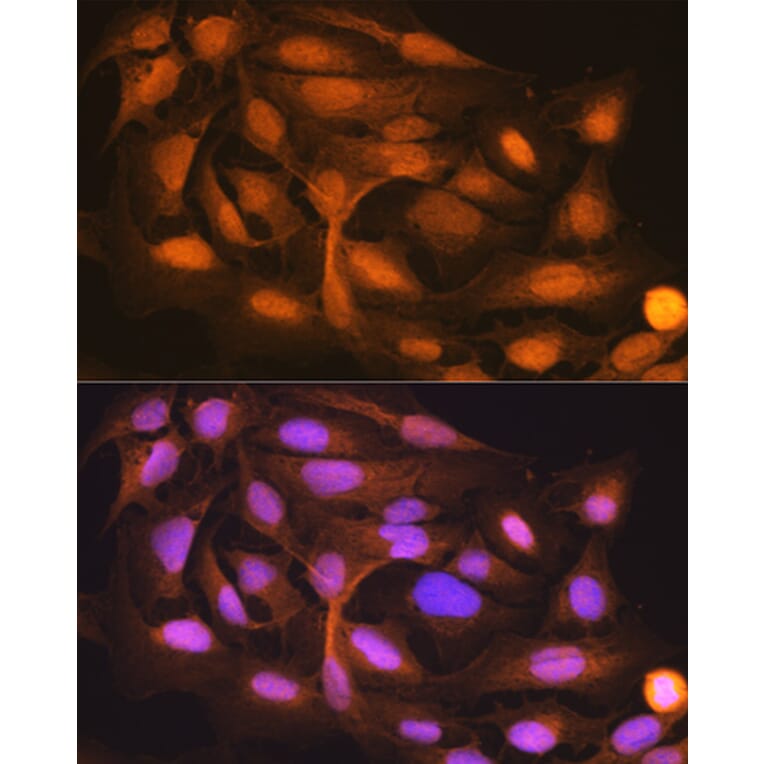 Immunofluorescence - Anti-ISG15 Antibody [ARC53794] (A307409) - Antibodies.com