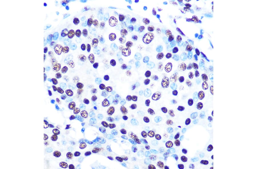 Immunohistochemistry - Anti-SFPQ Antibody [ARC0788] (A307412) - Antibodies.com