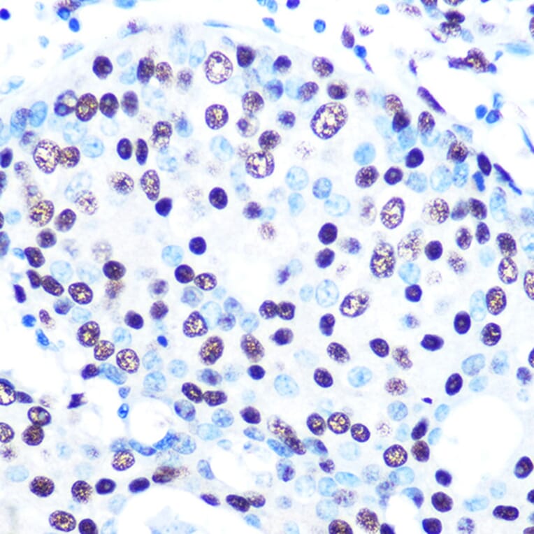 Immunohistochemistry - Anti-SFPQ Antibody [ARC0788] (A307412) - Antibodies.com
