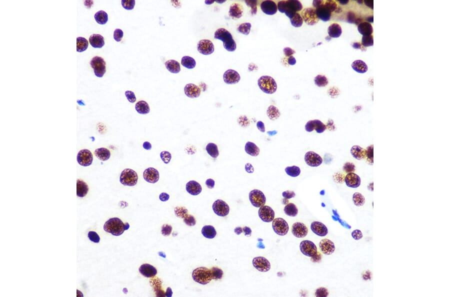 Immunohistochemistry - Anti-SFPQ Antibody [ARC0788] (A307412) - Antibodies.com