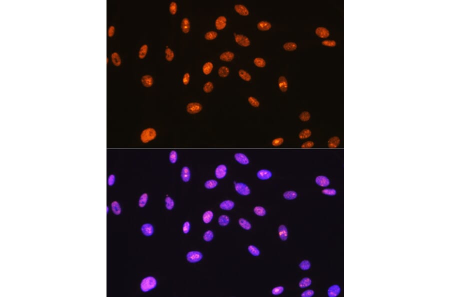 Immunofluorescence - Anti-SFPQ Antibody [ARC0788] (A307412) - Antibodies.com