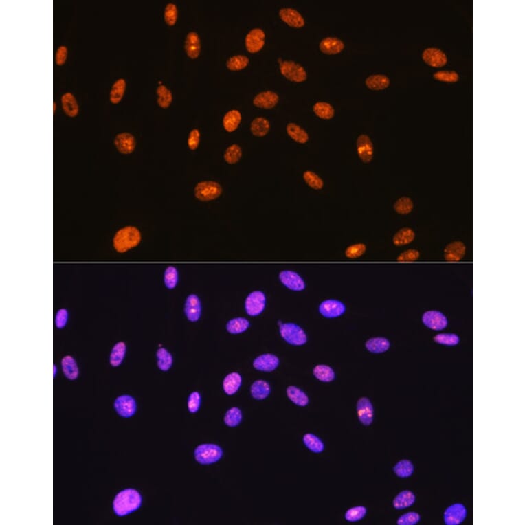 Immunofluorescence - Anti-SFPQ Antibody [ARC0788] (A307412) - Antibodies.com