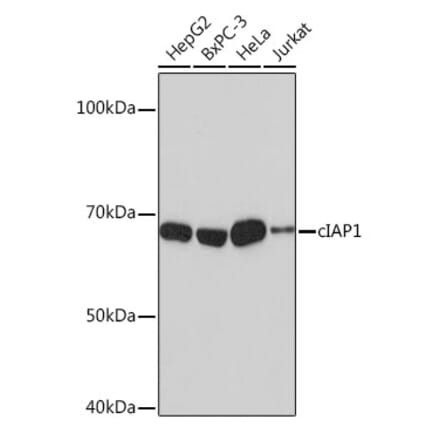 Western Blot - Anti-cIAP1 Antibody [ARC0168] (A307415) - Antibodies.com
