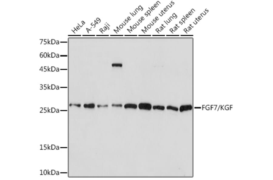 Western Blot - Anti-KGF/FGF-7 Antibody [ARC2107] (A307416) - Antibodies.com