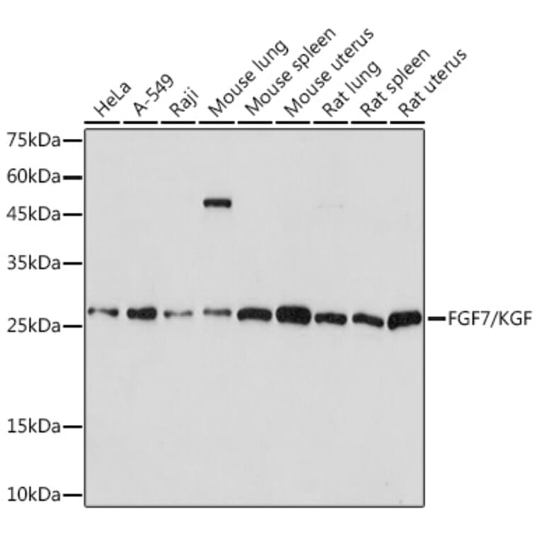 Western Blot - Anti-KGF/FGF-7 Antibody [ARC2107] (A307416) - Antibodies.com