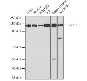 Western Blot - Anti-Lipin 1 Antibody [ARC1945] (A307417) - Antibodies.com