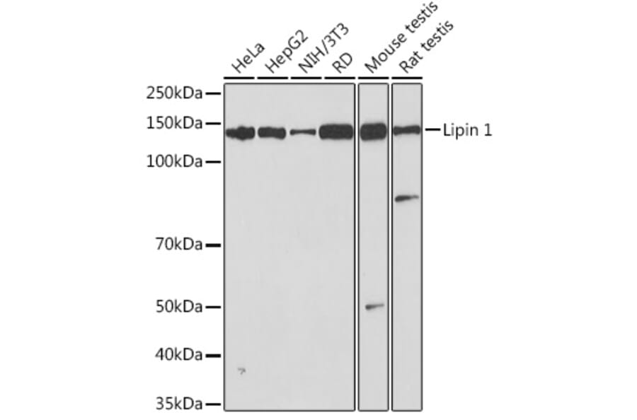 Western Blot - Anti-Lipin 1 Antibody [ARC1945] (A307417) - Antibodies.com