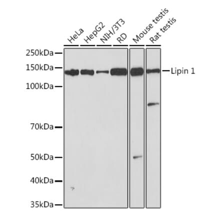 Western Blot - Anti-Lipin 1 Antibody [ARC1945] (A307417) - Antibodies.com