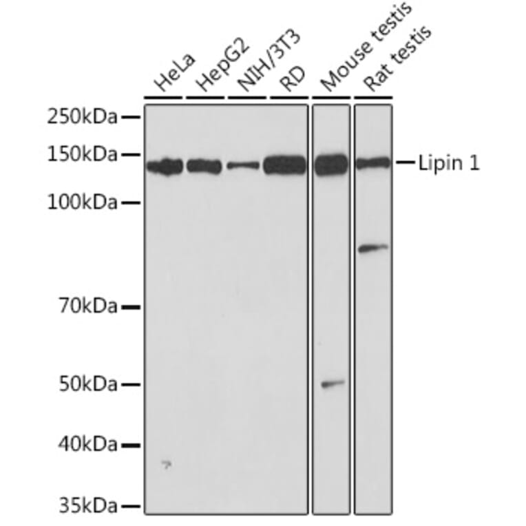Western Blot - Anti-Lipin 1 Antibody [ARC1945] (A307417) - Antibodies.com