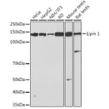Western Blot - Anti-Lipin 1 Antibody [ARC1945] (A307417) - Antibodies.com