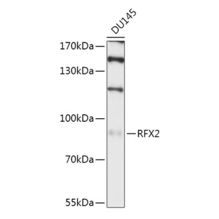 Western Blot - Anti-RFX2 Antibody (A307419) - Antibodies.com