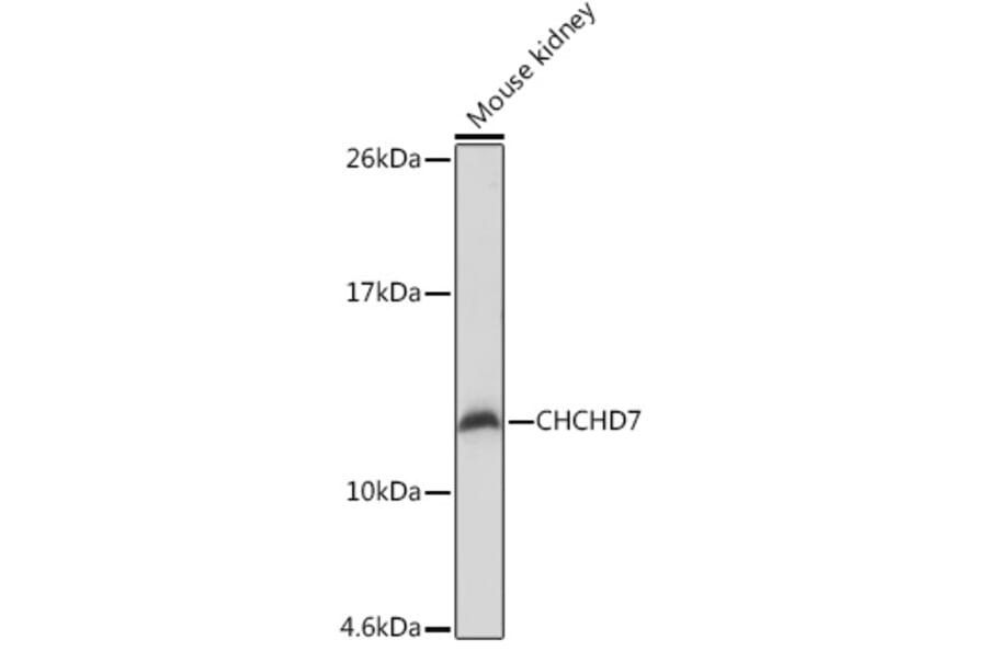 Western Blot - Anti-CHCHD7 Antibody (A307420) - Antibodies.com