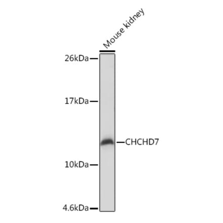 Western Blot - Anti-CHCHD7 Antibody (A307420) - Antibodies.com