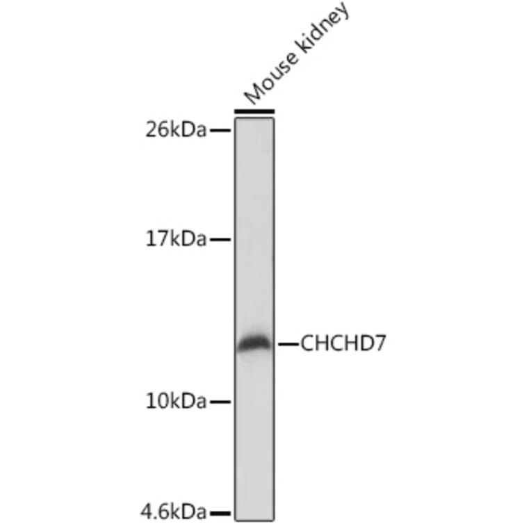 Western Blot - Anti-CHCHD7 Antibody (A307420) - Antibodies.com