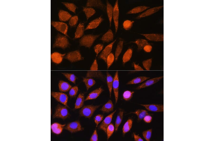 Immunofluorescence - Anti-CHCHD7 Antibody (A307420) - Antibodies.com