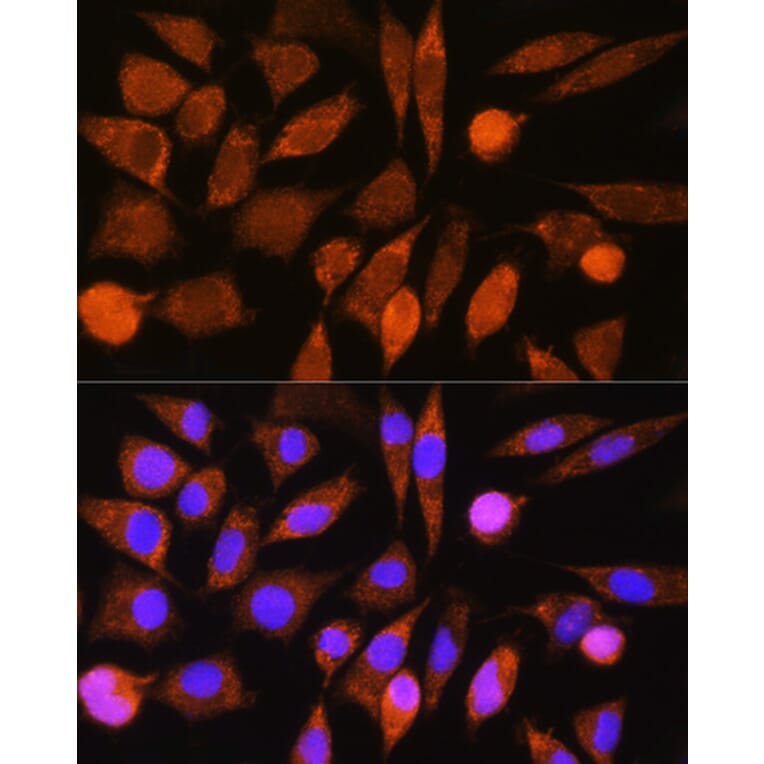 Immunofluorescence - Anti-CHCHD7 Antibody (A307420) - Antibodies.com