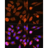 Immunofluorescence - Anti-CHCHD7 Antibody (A307420) - Antibodies.com