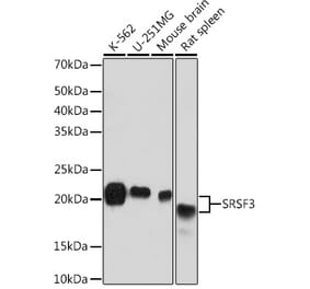 Western Blot - Anti-SRSF3 Antibody [ARC1394] (A307421) - Antibodies.com
