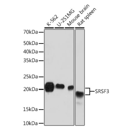 Western Blot - Anti-SRSF3 Antibody [ARC1394] (A307421) - Antibodies.com