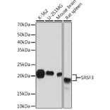 Western Blot - Anti-SRSF3 Antibody [ARC1394] (A307421) - Antibodies.com