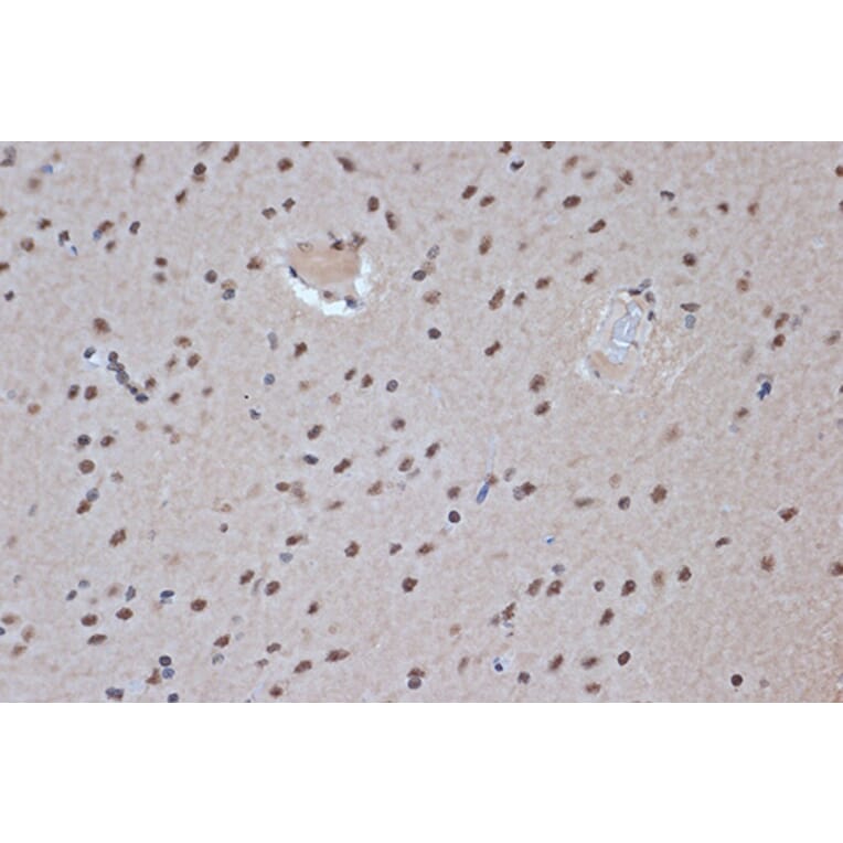 Immunohistochemistry - Anti-SRSF3 Antibody [ARC1394] (A307421) - Antibodies.com
